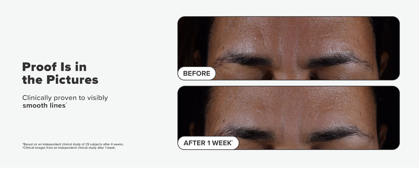 Paula's Choice SKIN PERFECTING 2% BHA Liquid Salicylic Acid Exfoliant-Facial Exfoliant for Blackheads, Enlarged Pores, Wrinkles & Fine Lines 24hrsmart