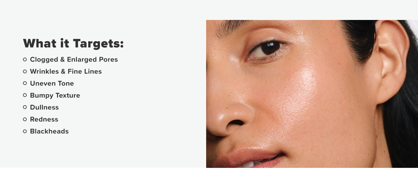 Paula's Choice SKIN PERFECTING 2% BHA Liquid Salicylic Acid Exfoliant-Facial Exfoliant for Blackheads, Enlarged Pores, Wrinkles & Fine Lines 24hrsmart