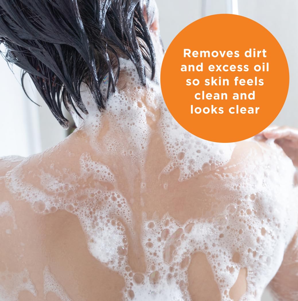 PanOxyl Acne Treatment Bar with 10% Benzoyl Peroxide, Maximum Strength Acne Bar Soap for Face, Chest and Back, Benzoyl Peroxide Bar Soap Body Wash, Vegan, For Acne Prone Skin, 4 oz - 24hrsmart