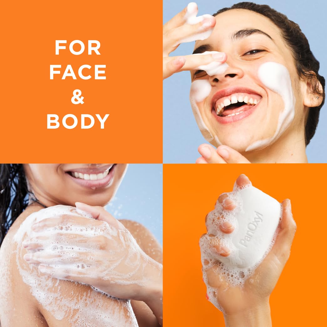 PanOxyl Acne Treatment Bar with 10% Benzoyl Peroxide, Maximum Strength Acne Bar Soap for Face, Chest and Back, Benzoyl Peroxide Bar Soap Body Wash, Vegan, For Acne Prone Skin, 4 oz - 24hrsmart