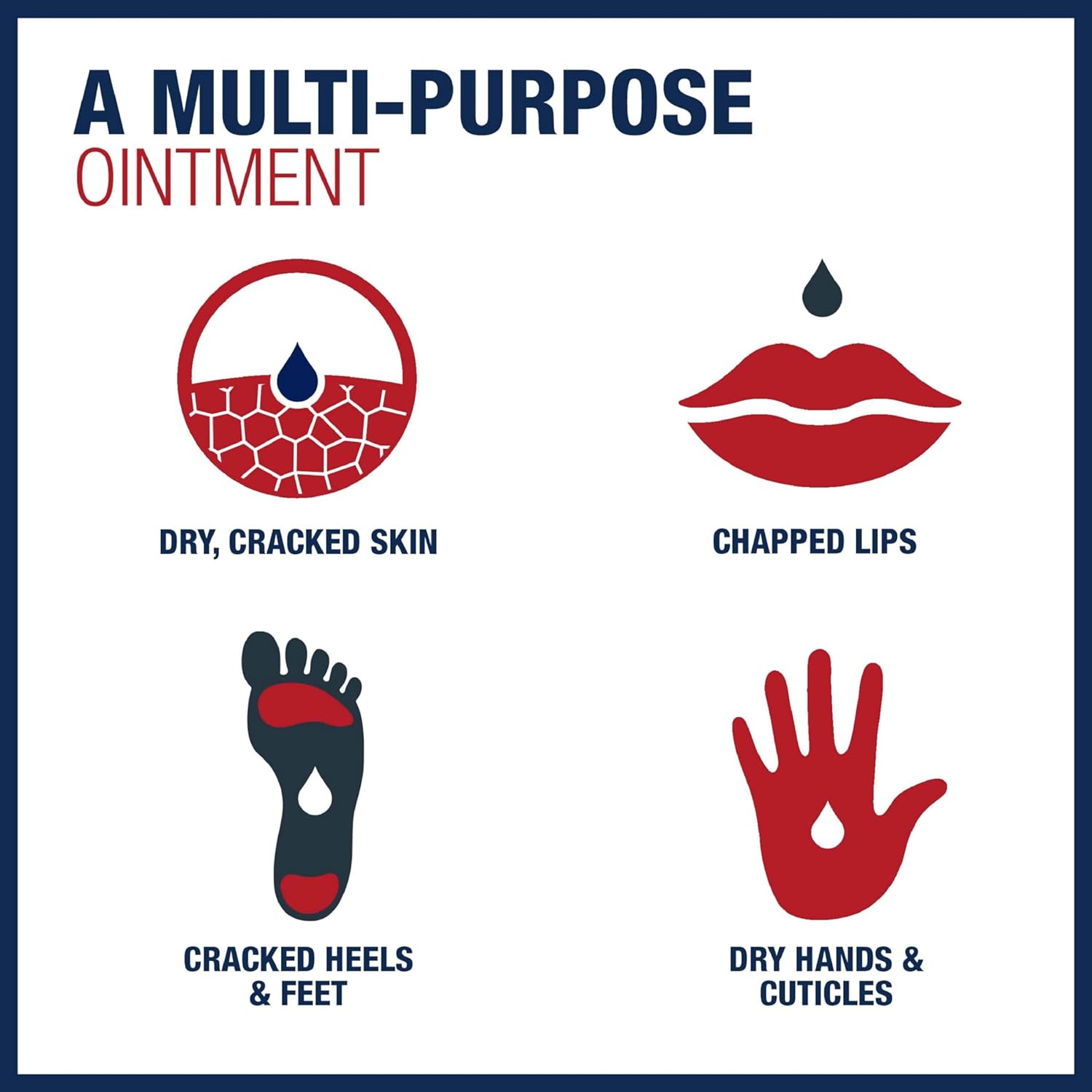 Aquaphor Healing Ointment, Advanced Therapy Skin Protectant, Dry Skin Body Moisturizer, Multi-Purpose Healing Ointment, For Dry, Cracked Skin & Minor Cuts & Burns, 14 Oz Jar - 24hrsmart