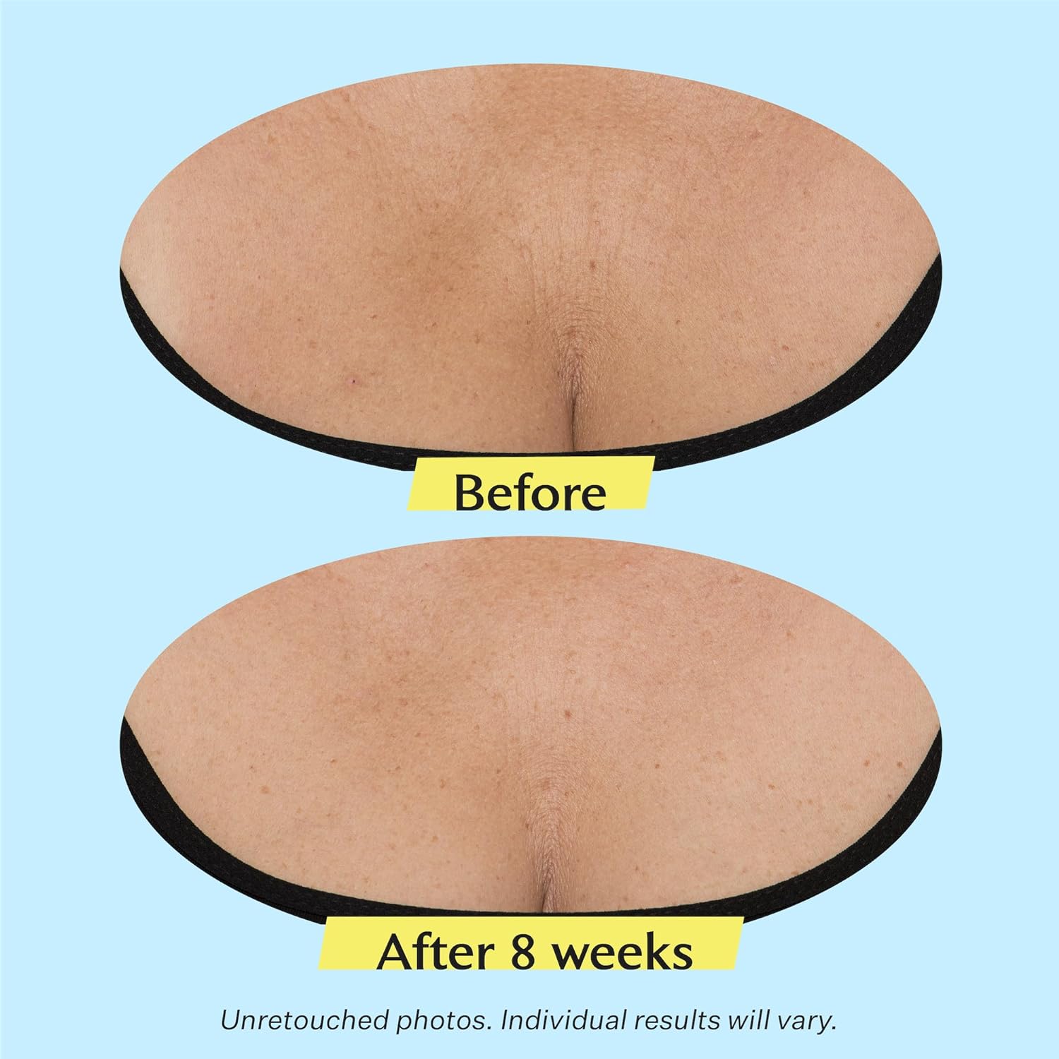 StriVectin Tighten & Lift Advanced Neck Cream PLUS with Alpha-3 Peptides™ for Neck & Décolleté 24Hr Smart