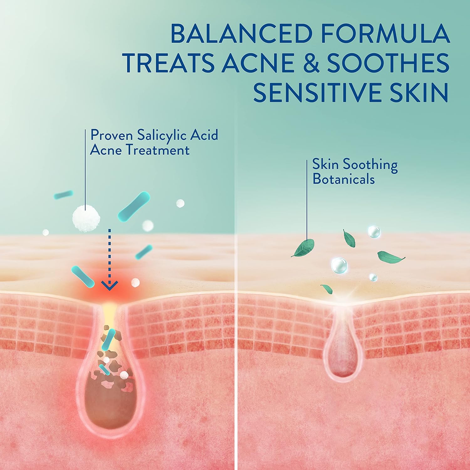 Cetaphil Face Moisturizer, Gentle Clear Mattifying Acne Moisturizer With 0.5% Salicylic Acid, Hydrates and Treats Sensitive Acne Prone Skin, Skin Care for Sensitive Skin, 3oz - 24hrsmart