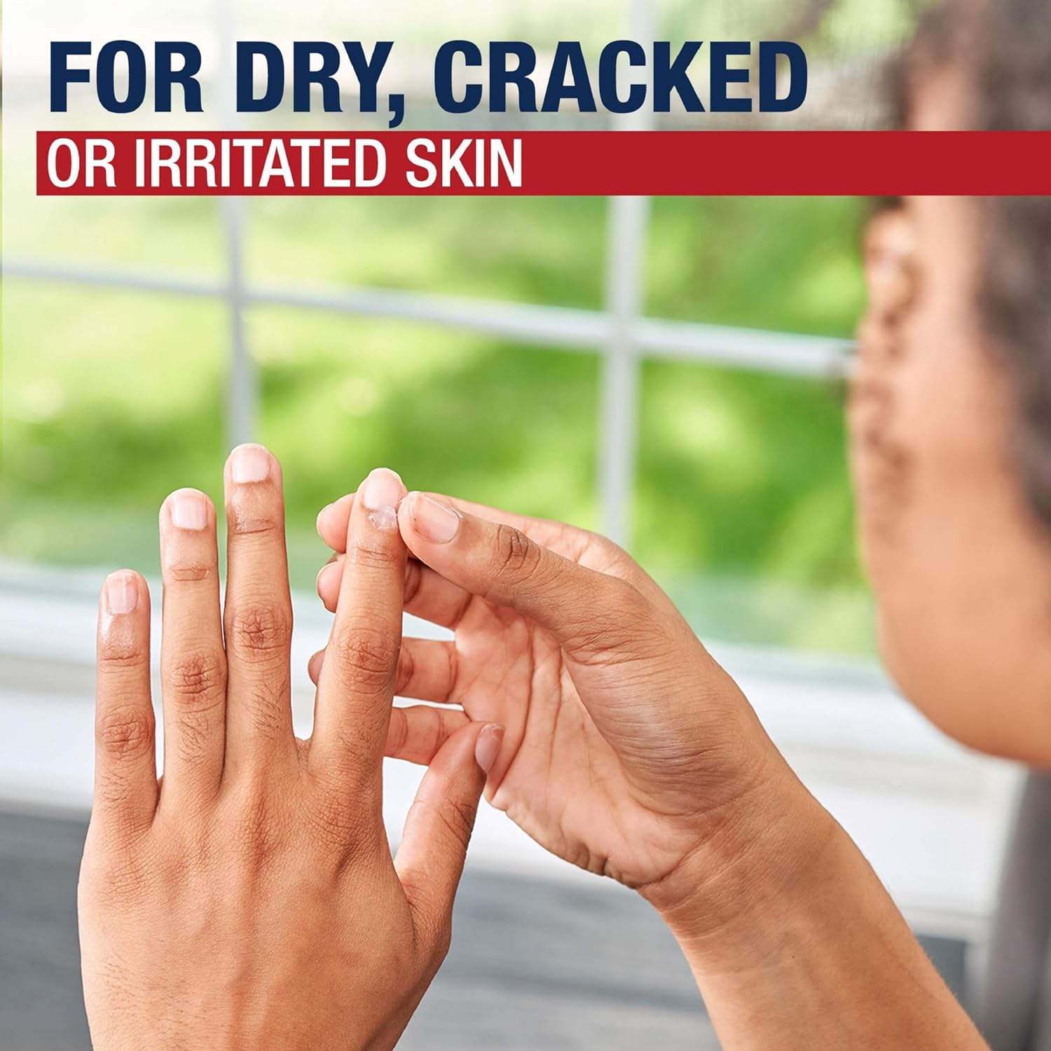 Aquaphor Healing Ointment, Advanced Therapy Skin Protectant, Dry Skin Body Moisturizer, Multi-Purpose Healing Ointment, For Dry, Cracked Skin & Minor Cuts & Burns, 14 Oz Jar - 24hrsmart