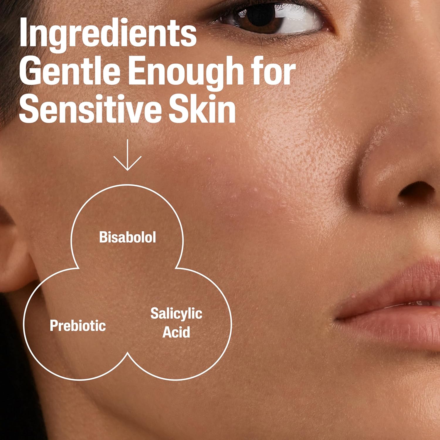 Cetaphil Face Moisturizer, Gentle Clear Mattifying Acne Moisturizer With 0.5% Salicylic Acid, Hydrates and Treats Sensitive Acne Prone Skin, Skin Care for Sensitive Skin, 3oz - 24hrsmart