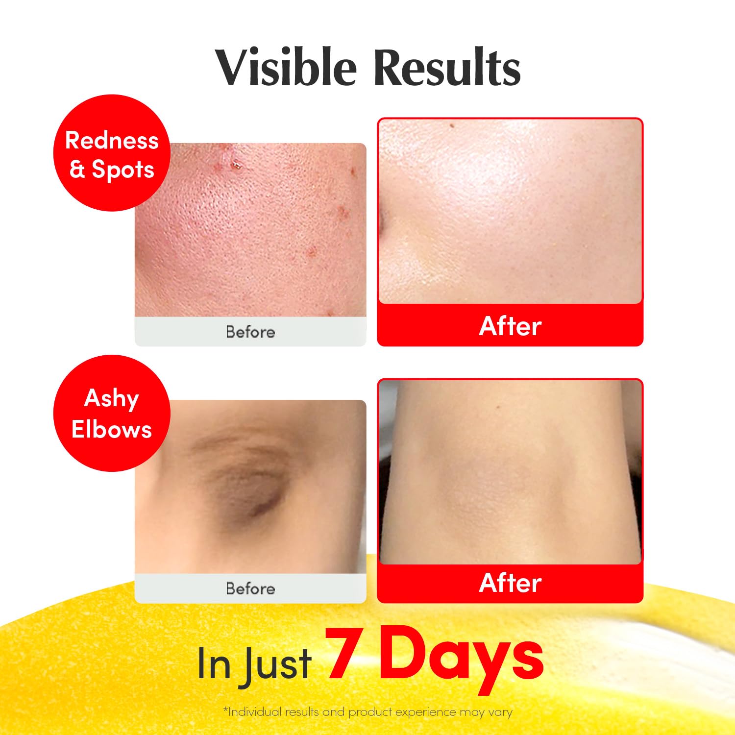 EQQUALBERRY Vitamin Illuminating Serum | Niacinamide 4% + Brightening Vitamin C Face Serum with Hyaluronic Acid & Vitamin E | Dark Spot, Uneven Tone Care | Korean Skincare, 1.01 fl.oz - 24hrsmart