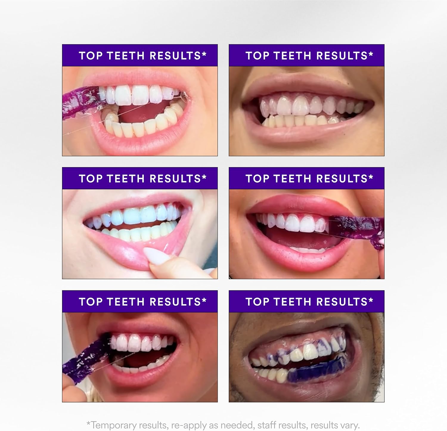Hismile V34 Teeth Whitening Strips - 24hrsmart