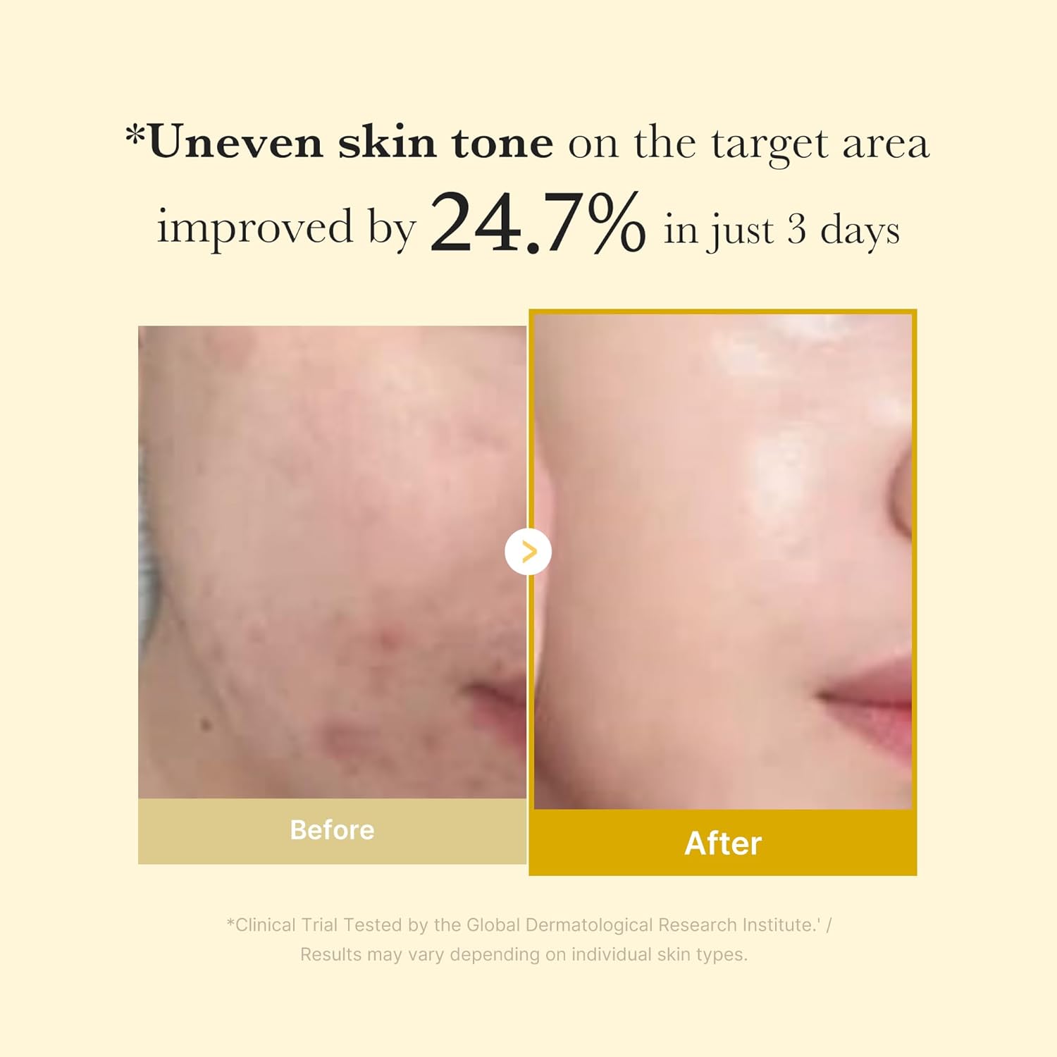 Medicube Collagen Overnight Mask – Peel - Off Facial Pack for Hydration & Anti - Aging - 24hrsmart