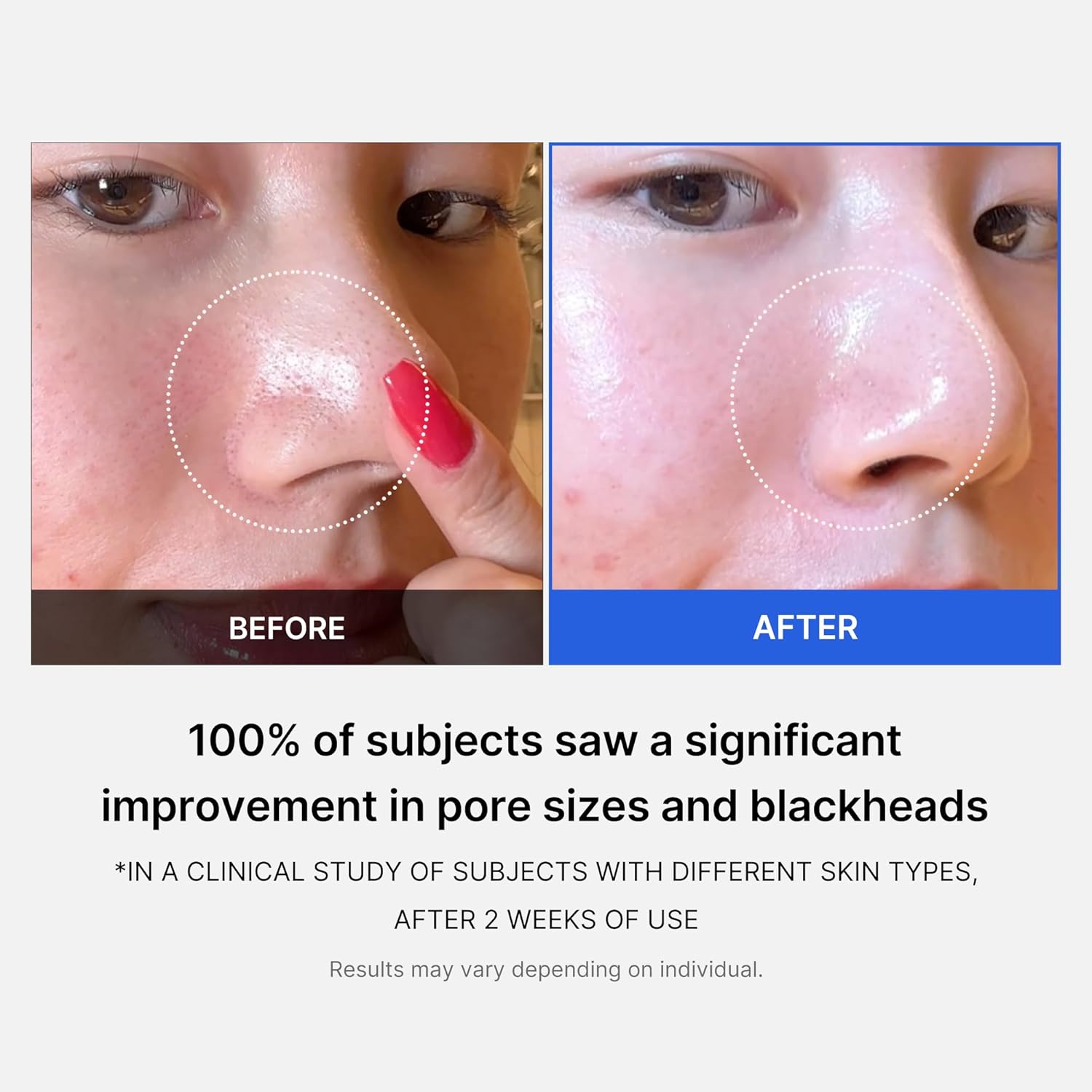 Medicube Zero Pore Pads 2.0 – Dual - Textured Exfoliating Toner Pads with 4.5% AHA & 0.45% BHA – 70 Pads - 24hrsmart